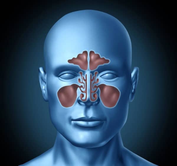 Los Angeles Sinusitis Treatment, Sinusitis Specialist Los Angeles, Chronic Sinusitis Doctor Los