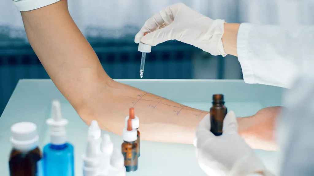 Allergy-testing Allergy-testing