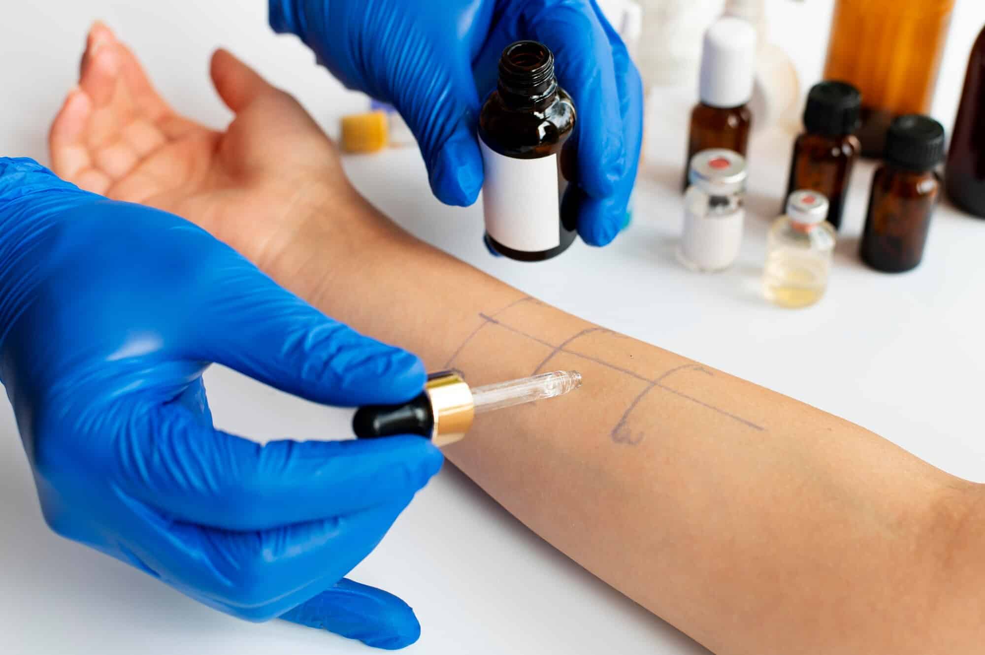 drug compounding for skin test